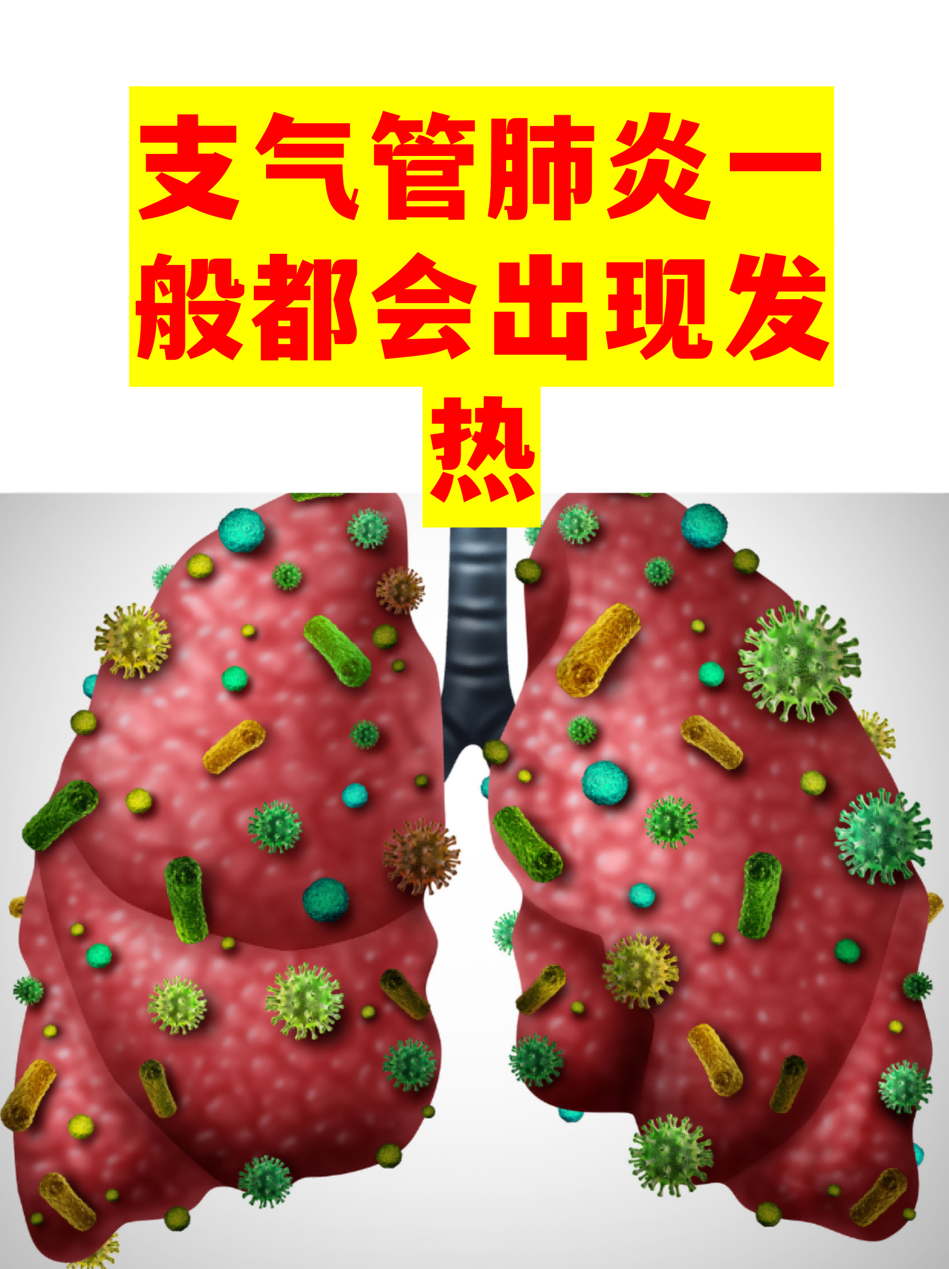 「重庆永川疫情」〃重庆永川区新型肺炎疫情最新情况-第2张图片