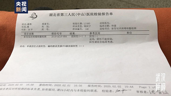 【吐鲁番地区肺炎/吐鲁番新冠肺炎确诊】-第1张图片