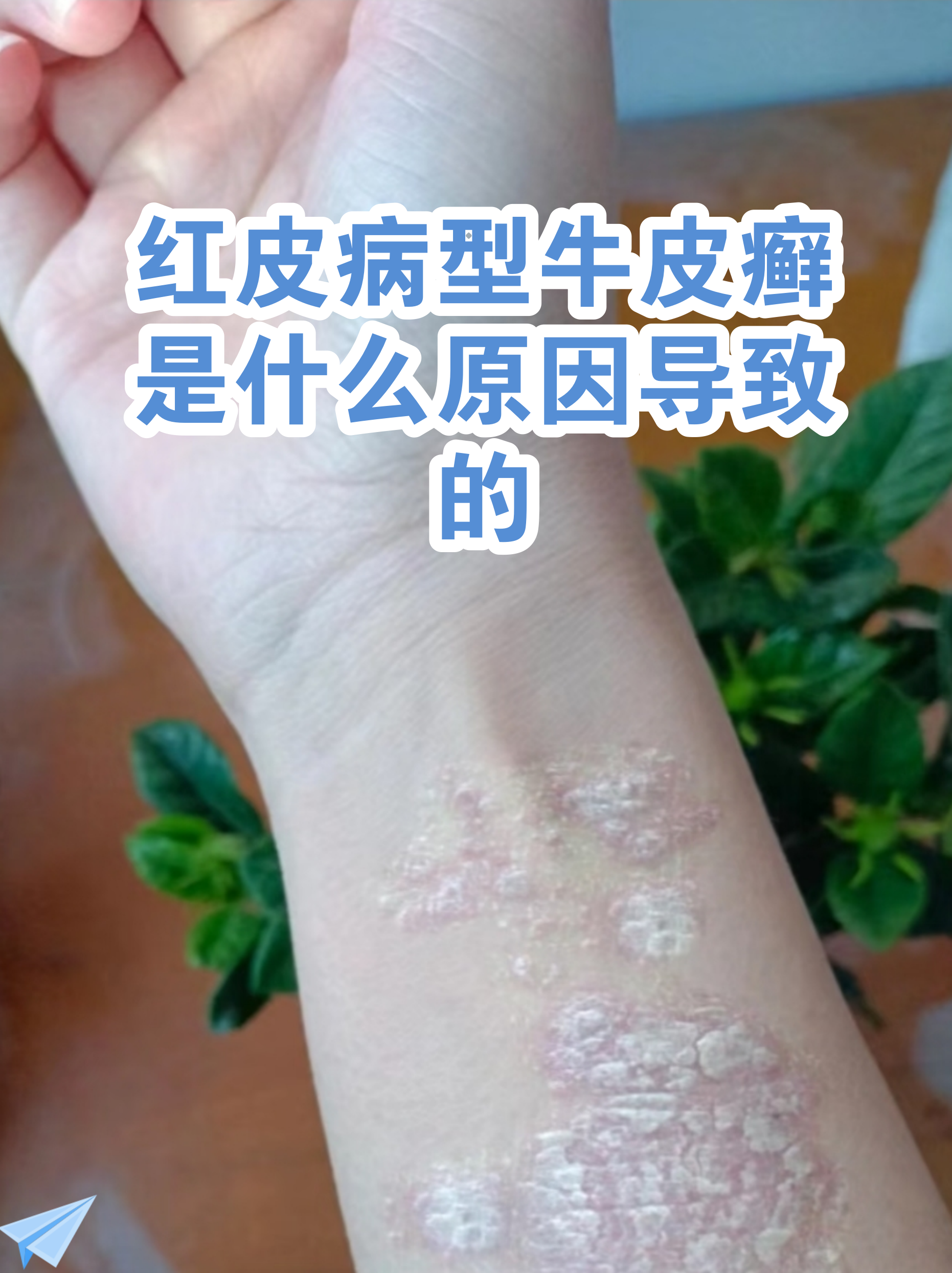 “最新病毒感染2019	” 最新病毒感染什么症状？-第3张图片