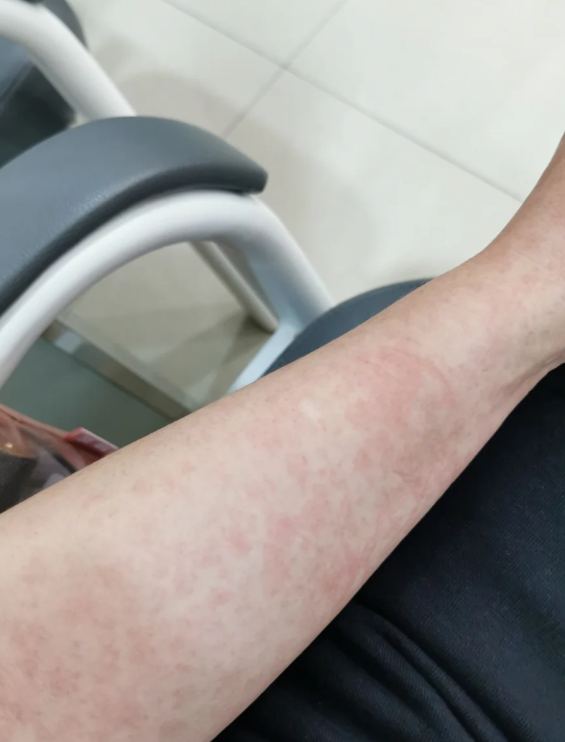 “最新病毒感染2019” 最新病毒感染什么症状？-第2张图片