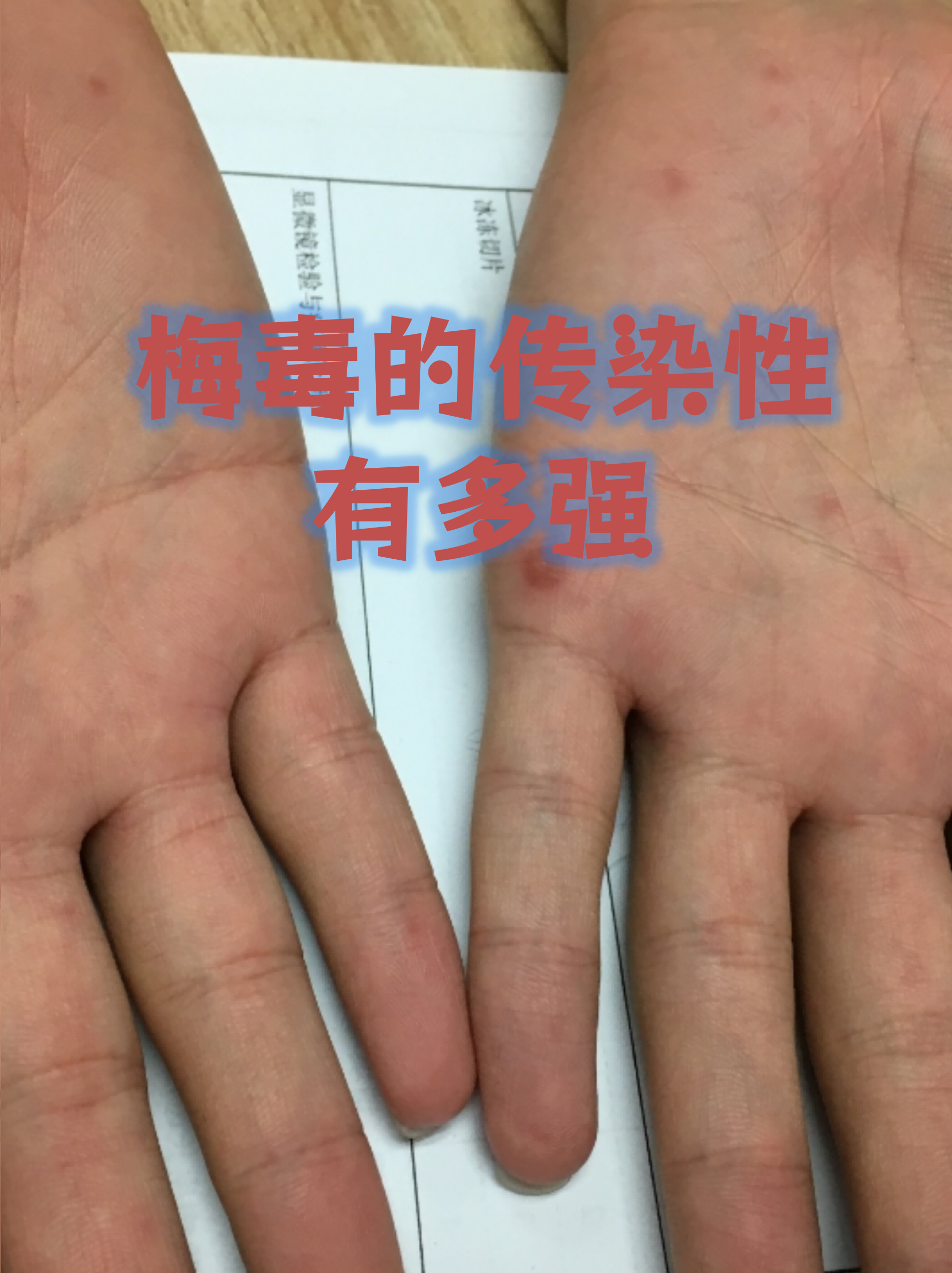 “北京本起疫情初判传播风险高” 北京疫情现超级传播？-第3张图片
