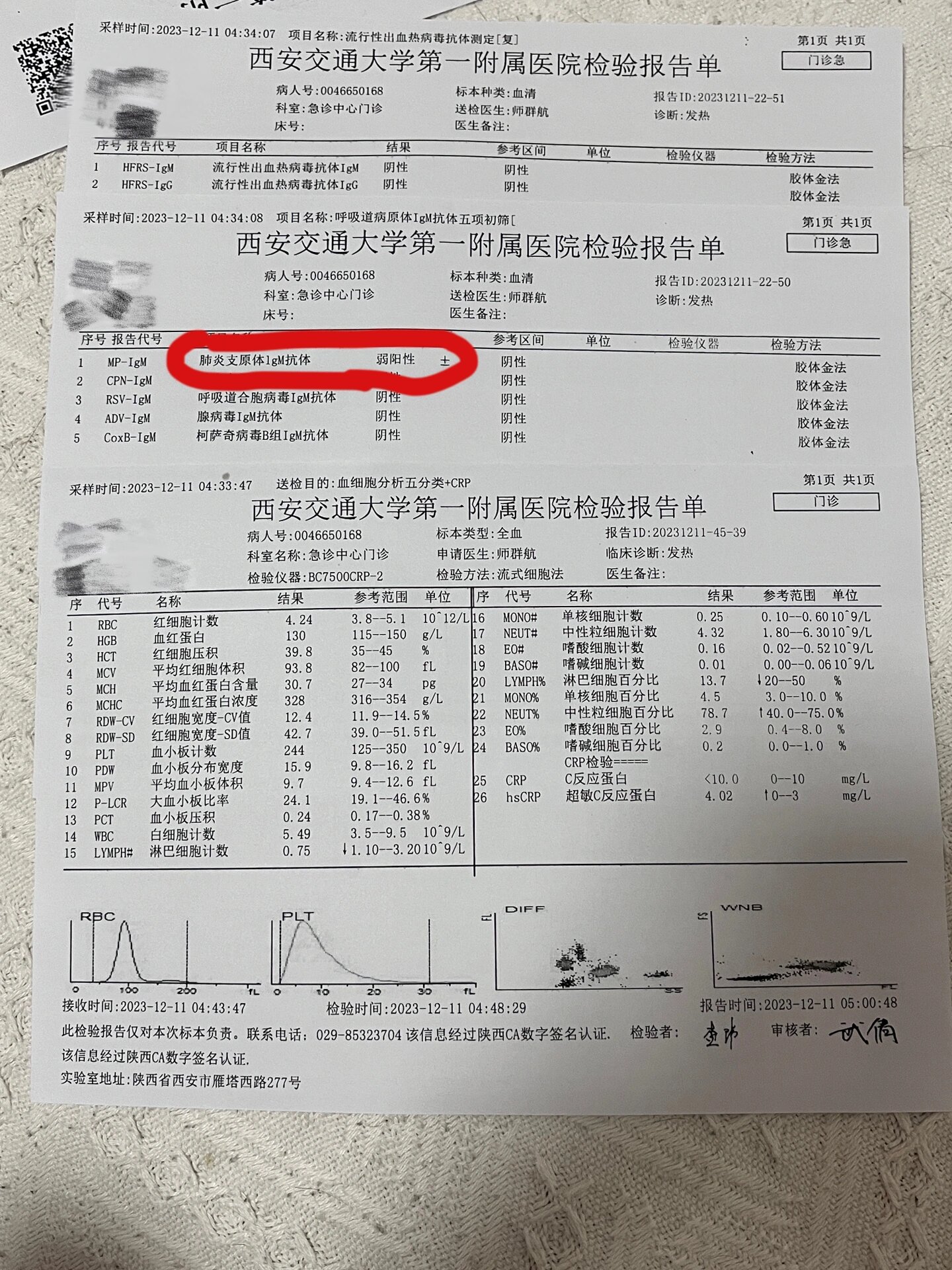 西安新增1例本土.西安新增1例确诊-第1张图片