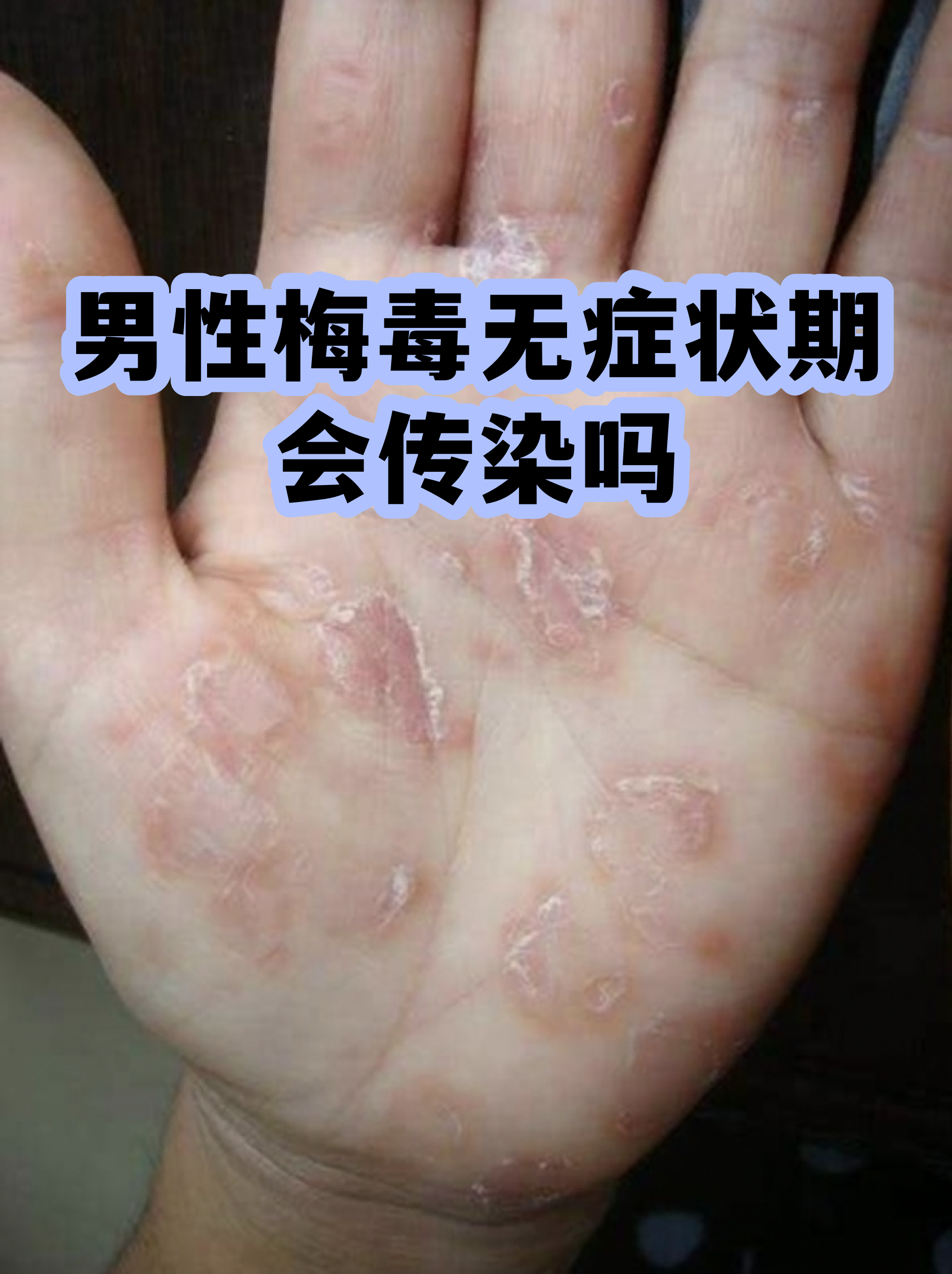 “四川无症状感染者” 四川 无症状？-第2张图片