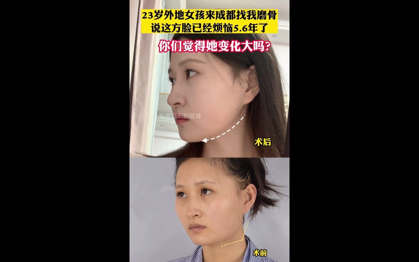 「成都确诊」〃成都确诊女孩一般接触者4725人-第3张图片