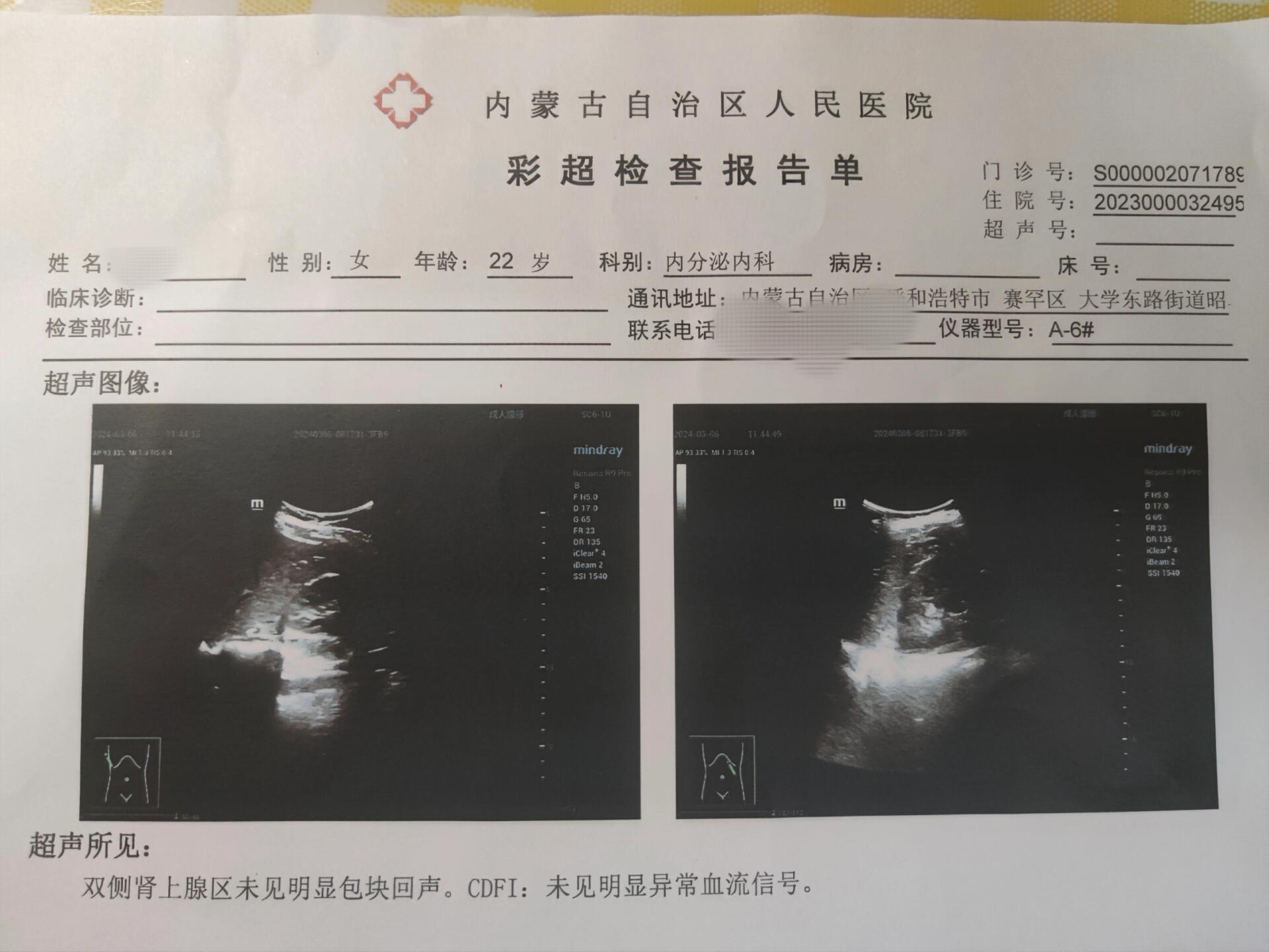 内蒙疫情-内蒙疫情最新新增病例-第2张图片